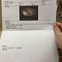 看的懂的姐妹们帮我看一下！ 末次11.7