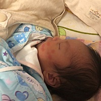 请问各位宝妈 我家宝宝脸上一块块红的 突然发出来.有经验的宝妈能告诉我这是不是过敏 谢谢了.