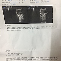 据说有人会从妊娠囊大小看男女，哈哈😄纯属娱乐，第一胎无所谓是男是女😁