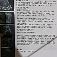 有没有能看懂四维单的