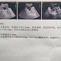 二胎啦，比较好奇宝宝性别，有会看的宝妈吗？