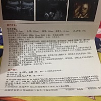 怎么我的四维跟别人的都不一样的呢，感觉不清晰