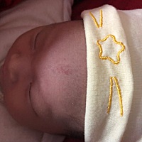 心里说不出的难过，宝宝额头上长了个胎记，真怕以后影响她生活