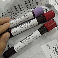 请问你们做这几项检查费用是多少，我们这里收费700多感觉有点贵