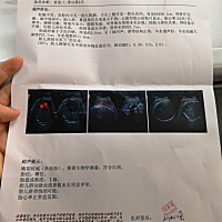 胎位不正😓😓 儿子还是女儿，好想知道，嘻嘻