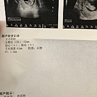 妈妈们这个nt正常么？