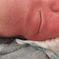 亲们，我家宝宝脸上长了好多红的，像是上火还是怎么了，求有经验的宝妈分享经验，帮忙看看怎么回事