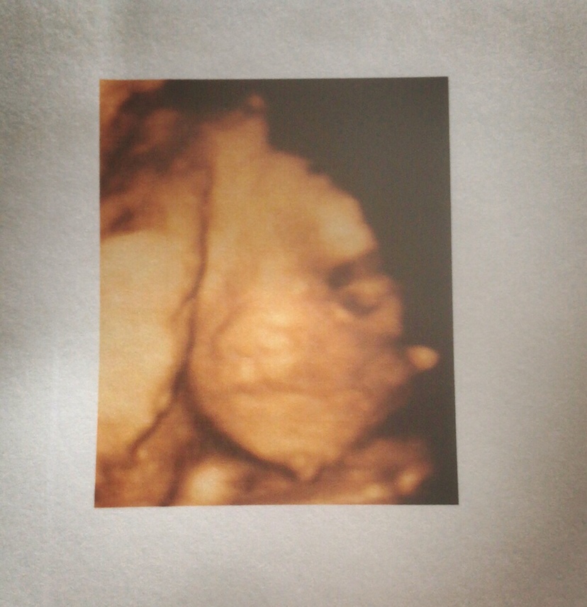 大鼻子的猪宝宝哈哈哈哈