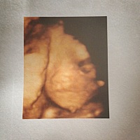 大鼻子的猪宝宝哈哈哈哈