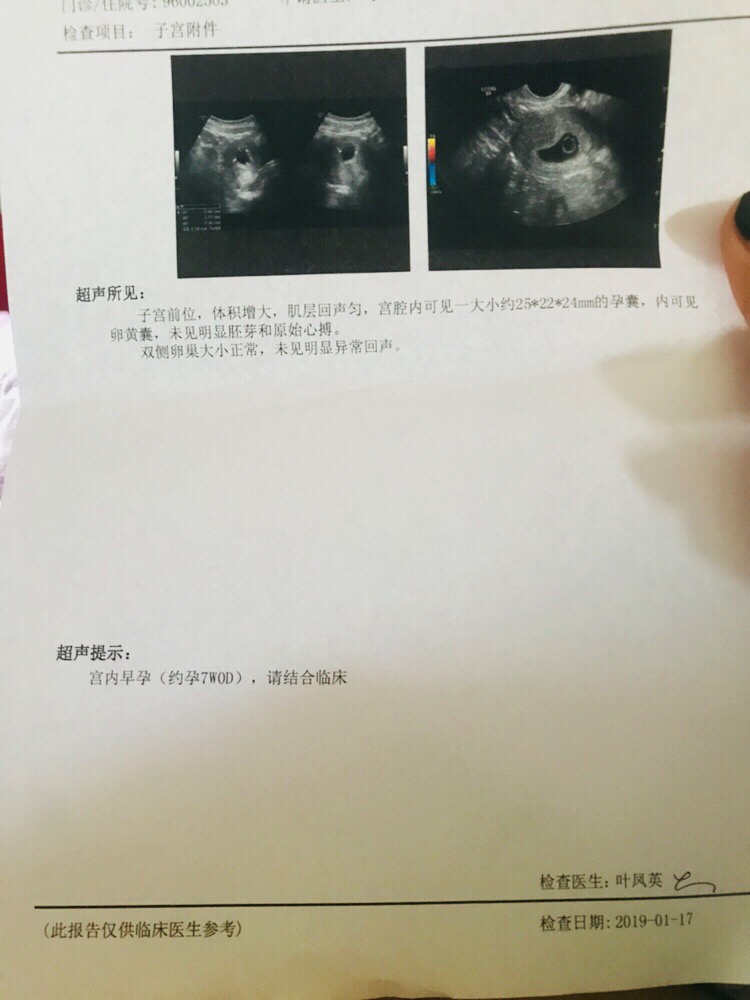 有没有出现比较晚的