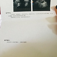 医生看到这个结果、建议我不要？谁能不能帮我看看、有没有情况跟我差不多的姐妹、有没有胚芽和心搏出现...