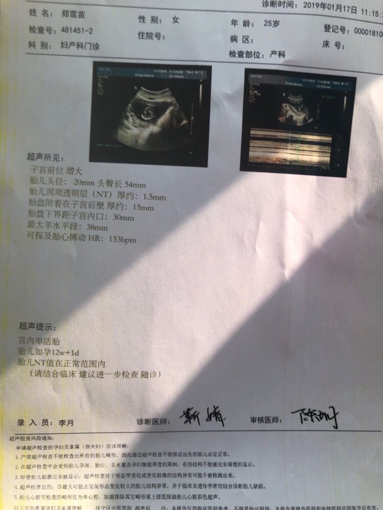 请问有会看男女宝宝的吗？