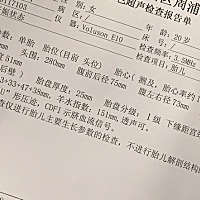 有没有能看出来是女宝宝还是男宝宝的呀 现在29周多啦 😁