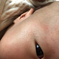 有宝妈知道宝宝脸上是什么吗？要不要涂点药，有好几天了