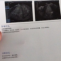 我最后一次月经是11月6号来的 12月份没有来然后我用试孕纸试了并没有怀孕了 一直到12月30号去看中医那会...