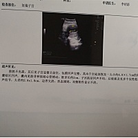 48天的时候有点褐色分泌物，医生开了两盒保胎药吃了后拉肚子，就像来大姨妈一样坠痛，这两天孕反应突然...