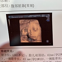 男孩女孩啊😱好激动的感觉，我的小宝贝