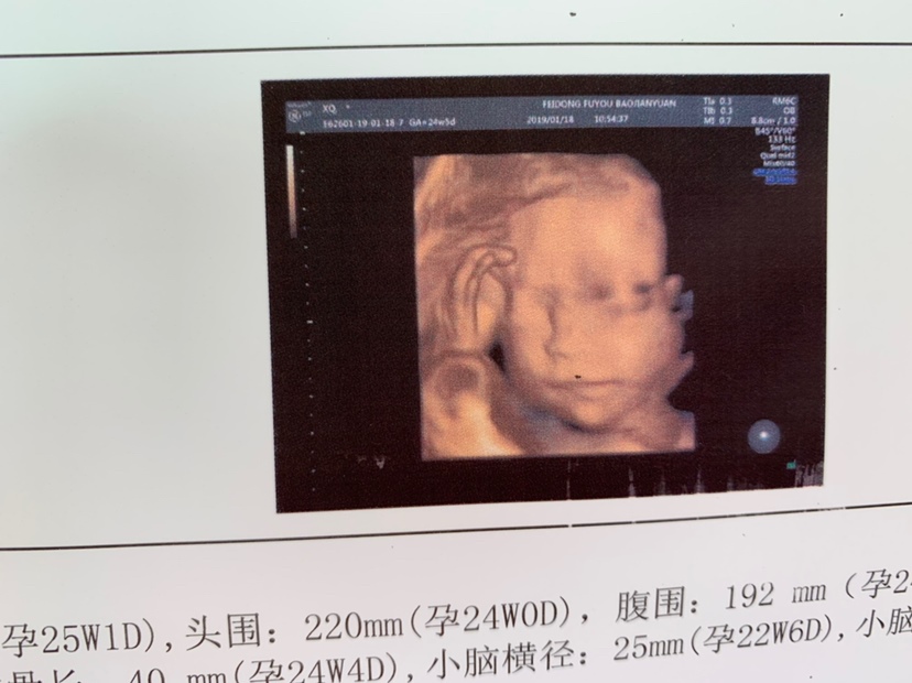 男孩女孩啊😱好激动的感觉，我的小宝贝