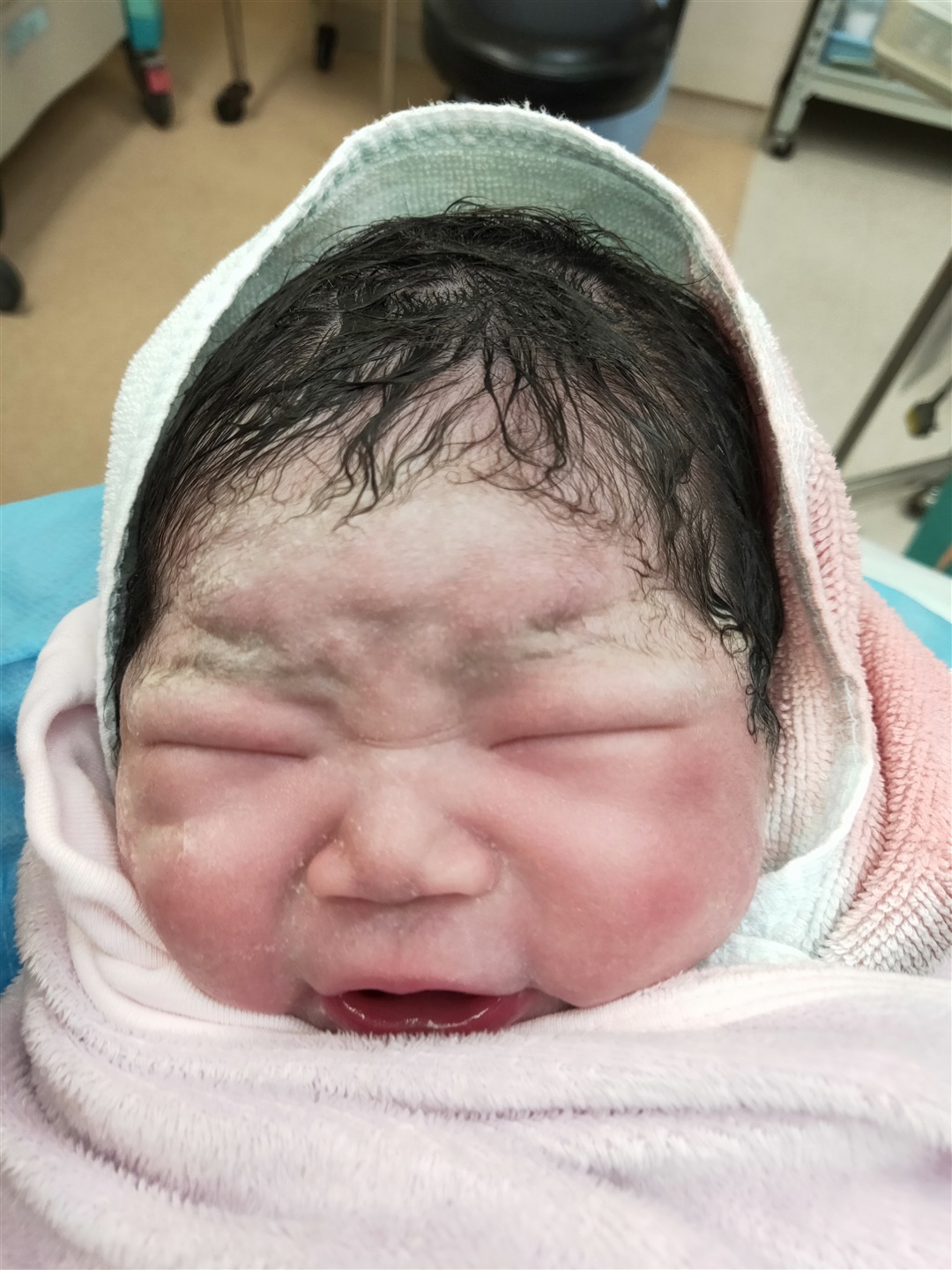 我的小宝贝。出生水肿呢。