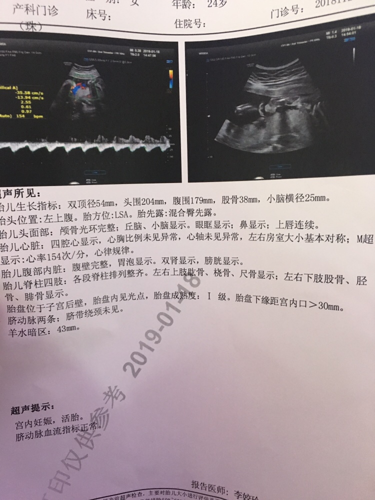 好无语啊，医生为什么不截图脸给我看呢？我想看妹妹长得像爸爸还是妈妈呀