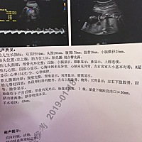 好无语啊，医生为什么不截图脸给我看呢？我想看妹妹长得像爸爸还是妈妈呀