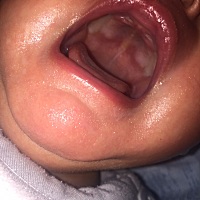 这是马牙还是要上牙！宝妈们帮忙看看吧！谢谢🙏