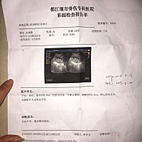 因为两个多月了没有来月事了，今天去检查结果都怀孕2个多月了，一直想要一个宝宝，这突如其来的幸福吓得...