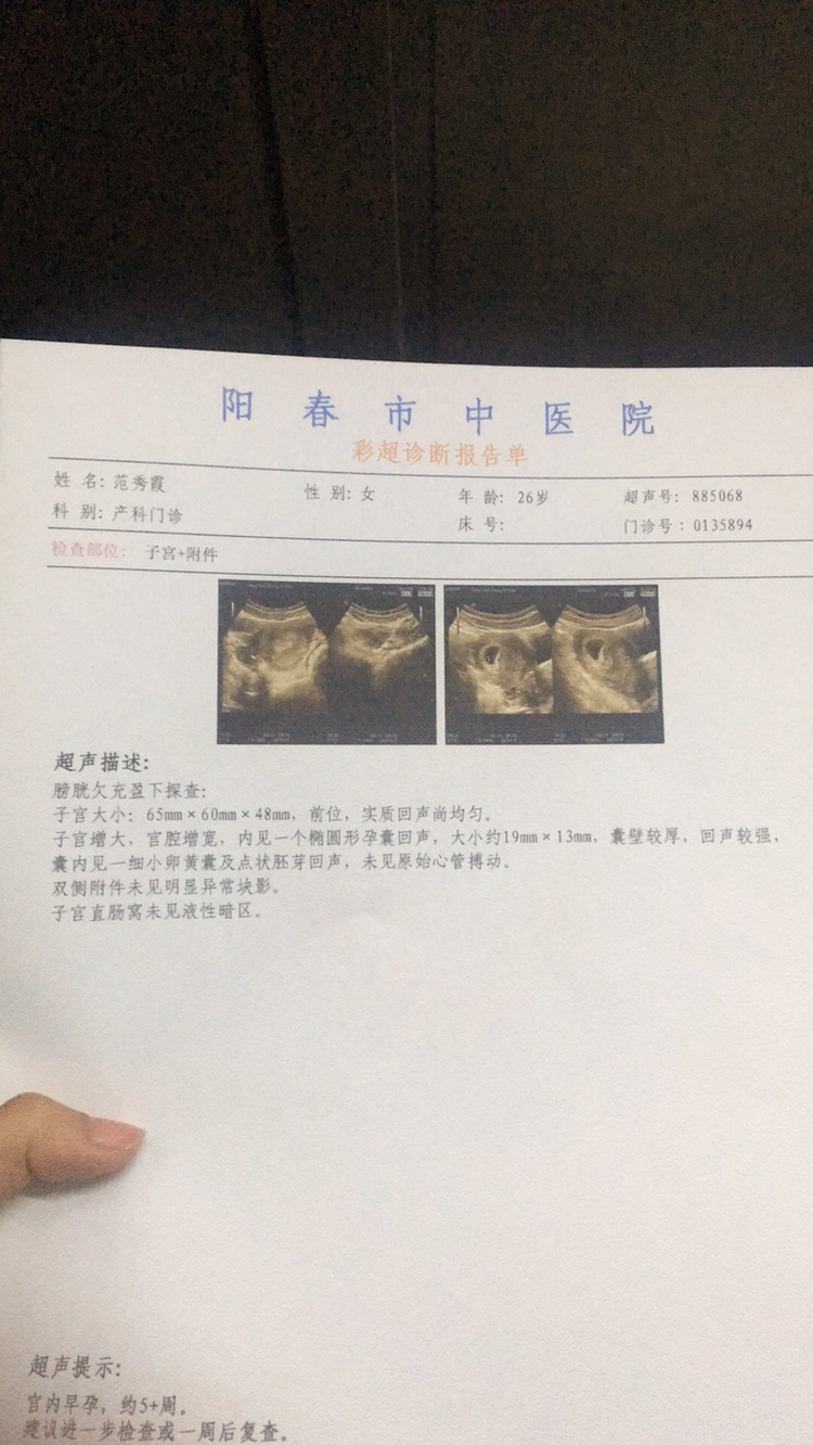 已有胎芽❤️。