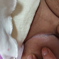 请问大家这是什么情况啊 该怎么办？