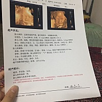 胎儿周数也不符，挤带绕颈一圈，不知道要不要紧。