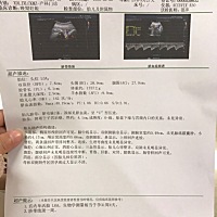 今天二维，脐带绕颈一周，宝宝3斤半重了！