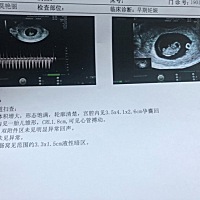都说孕囊能看宝宝是男孩还是女孩。有懂的妈妈帮我看看么，谢谢啦。