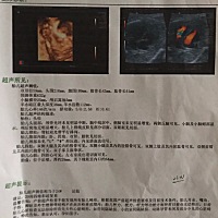 我想问一下！这张单子能看出男孩还是女孩纸吗？