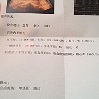 能看出是男宝还是女宝吗