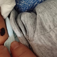 有人知道这是什么痣吗，宝宝出生就有，在大腿上，我每天看着真的 好担心