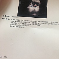 二胎不知男女，好想凑个好字。