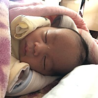 宝宝皮肤好干，身上都是脱皮