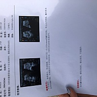 谁告诉我这是有了还是没有？