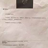 有没有人懂子宫内膜异位的