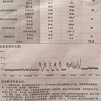 这样的结果有必要做盆底肌康复没