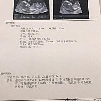 从刚开始你的到来，妈妈的心里别提有多高兴，虽然从怀你开始妈妈瘦了差不多10斤，现在5个月了，妈妈...