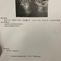 热乎乎的胎心，都来猜下是男女#(太开心)孕前酸辣都喜欢吃，现在偏喜欢辣一点，不知道是不是不能吃的东西...