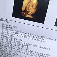 四维和宝宝真的好像吧？