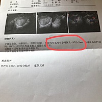 双胞胎的几率大不大呀？昨天刚去医院，医生说还太小，过段时间才看的到。