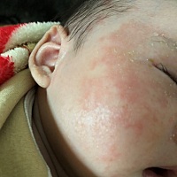 有宝妈知道这个怎么了怎么办吗？