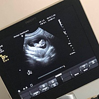 80天看男女，准不准？ p