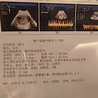 生理弯曲度未见明显异常，是不是女宝啊😄