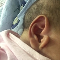 有没有宝宝的耳朵是这样的？不知道有没有影响。以后会不会和耳朵一起长大？有懂得请指教一下。谢谢