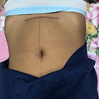 生的时候150斤，生完娃140，出院的时候全身都是肿的！月子里月嫂给做的一天六顿饭，出月子时候120！后来...