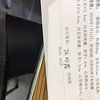 记录一下 我的双胞胎宝宝 今天九周啦